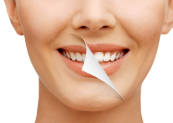 Tooth Whitening