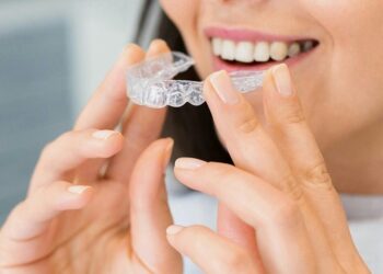 Invisible Braces Explained