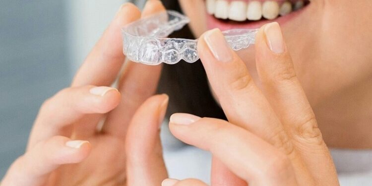 Invisible Braces Explained